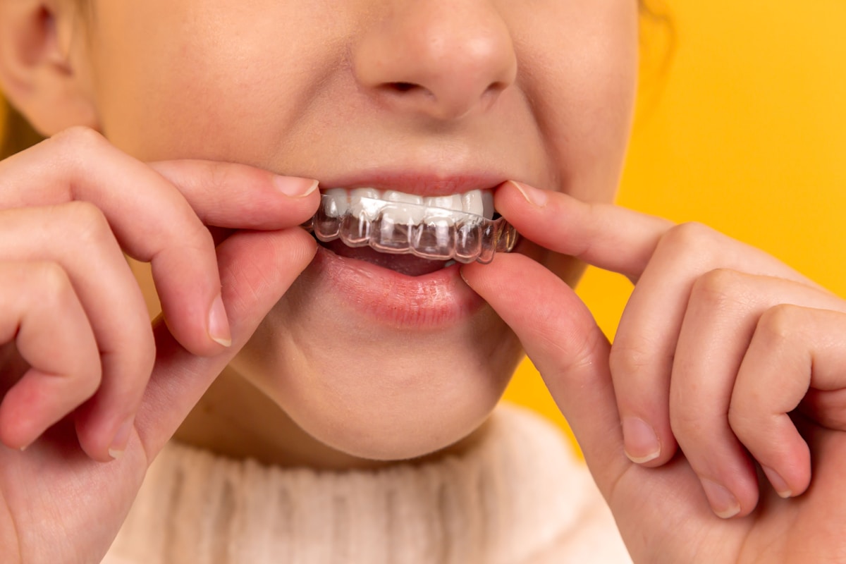 Clear Invisalign aligner tray held in hand